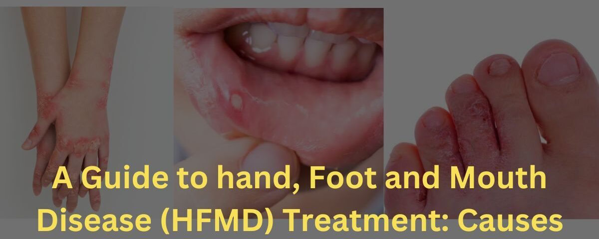 Hand, Foot, and Mouth Disease