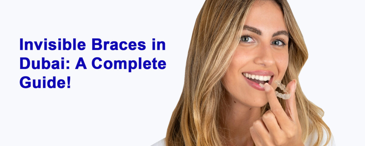 Invisible Braces in Dubai A Complete Guide