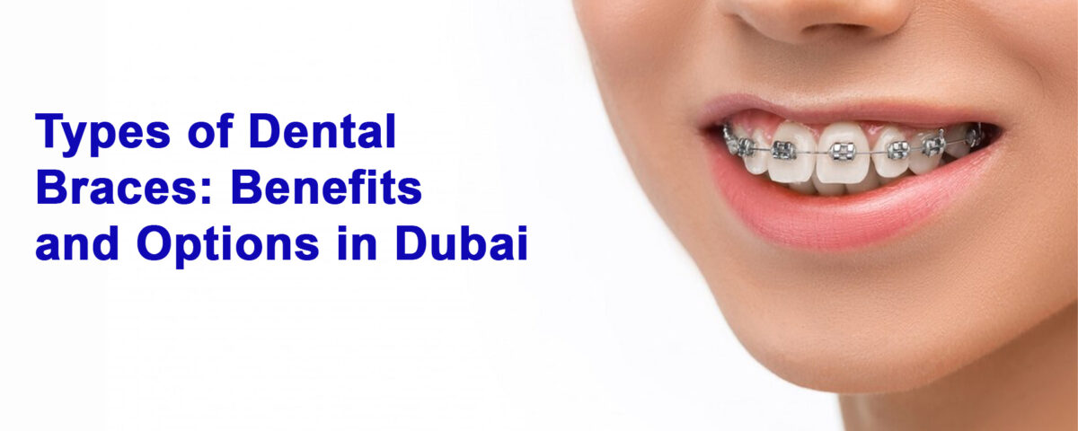 Types of Dental Braces Benefits and Options in Dubai