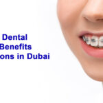 Types of Dental Braces Benefits and Options in Dubai