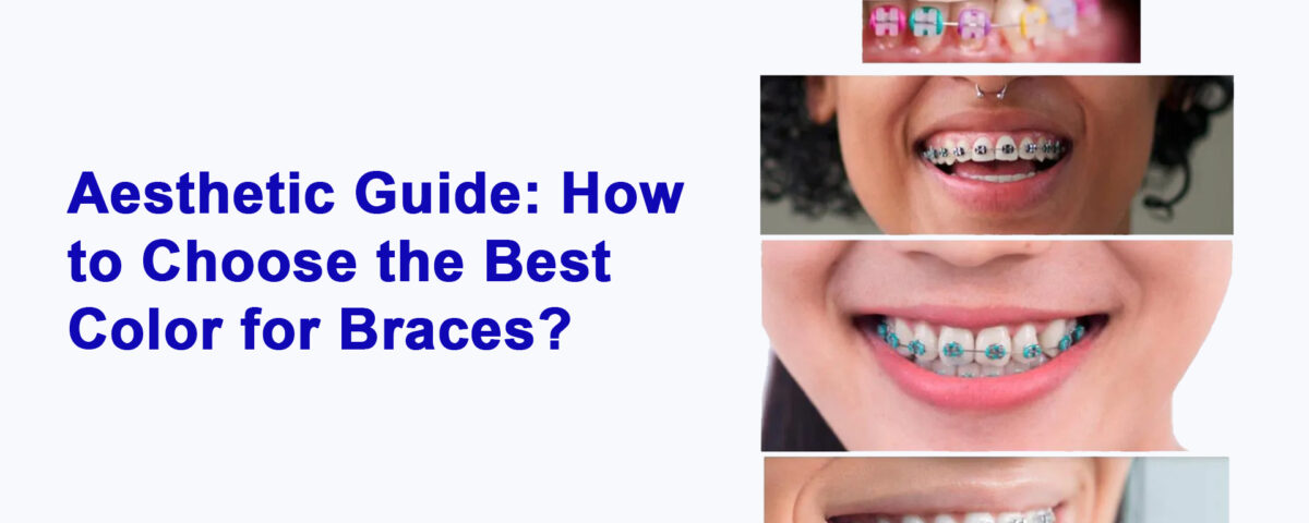 how to choose bes braces colors dental sharjah